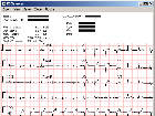 [C#] source code chương trình hiển thị, chỉnh sửa và lưu trữ điện tâm đồ (ECG)